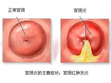 1492045945359186.jpg timg (13).jpg